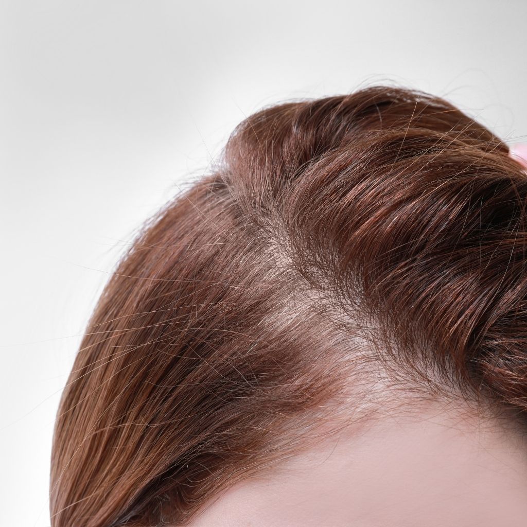 Haarausfall - Schönheit aus der Natur